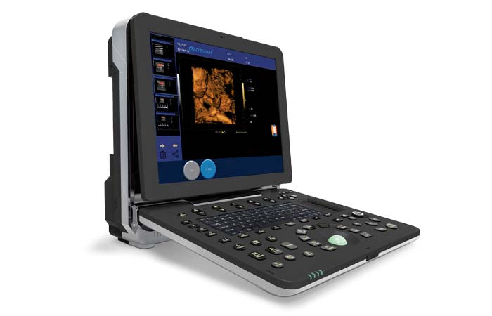 Portable Laptop Color Doppler Ultrasound 4D Scanner 15" LCD Display 128 Elements