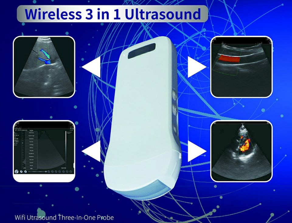 Color Wireless wifi Ultrasound 3-in-1 Convex, Linear, Cardiac Probe An –  WiFiUltras