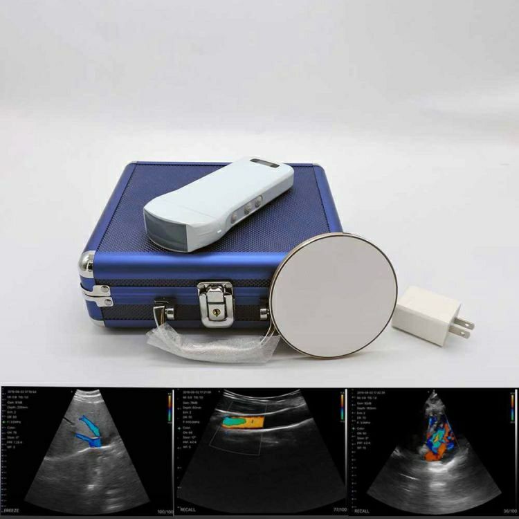 Color Wireless wifi Ultrasound 3-in-1 Convex, Linear, Cardiac Probe Android, iOS