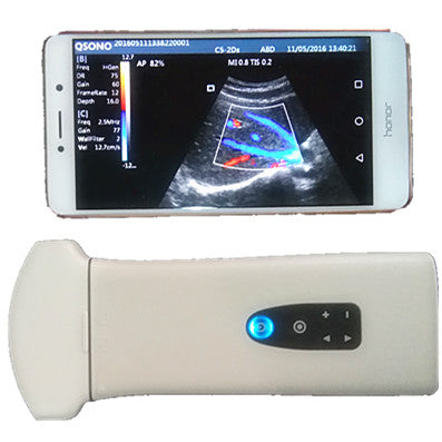 B/W Pocket Ultrasound System With Changeable Probe Heads: Linear, Convex, Micro Convex, Vaginal
