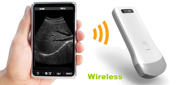 Wifi Wireless Convex Array Probe Type Ultrasound Scanner 3.5Mhz/64E + <B>FREE SHIPPING</B>