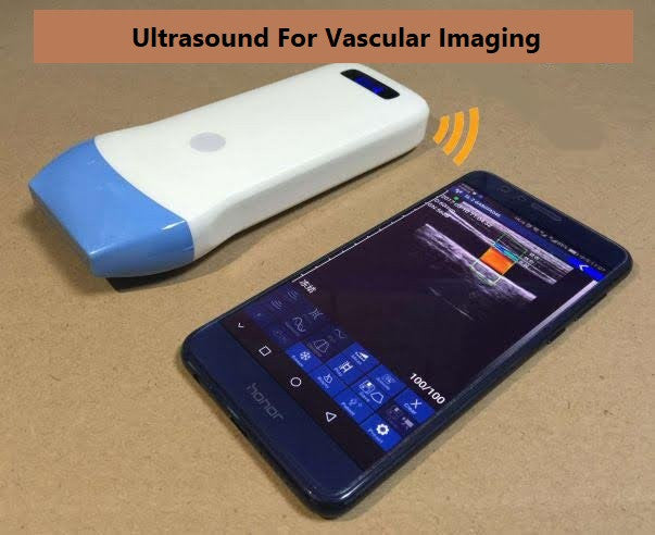 Color Wireless Portable Vascular Ultrasound Scanner Linear Probe Vary Frequency 7.5/10Mhz