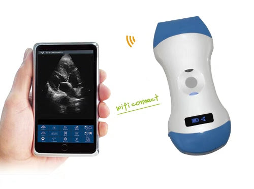 3-in-1 Color Doppler Double Head Wireless Ultrasound Scanner Convex Linear Phased Scan